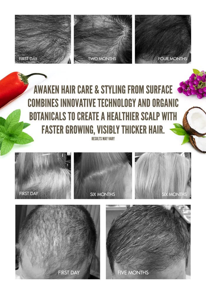 Surface Awaken Kit
