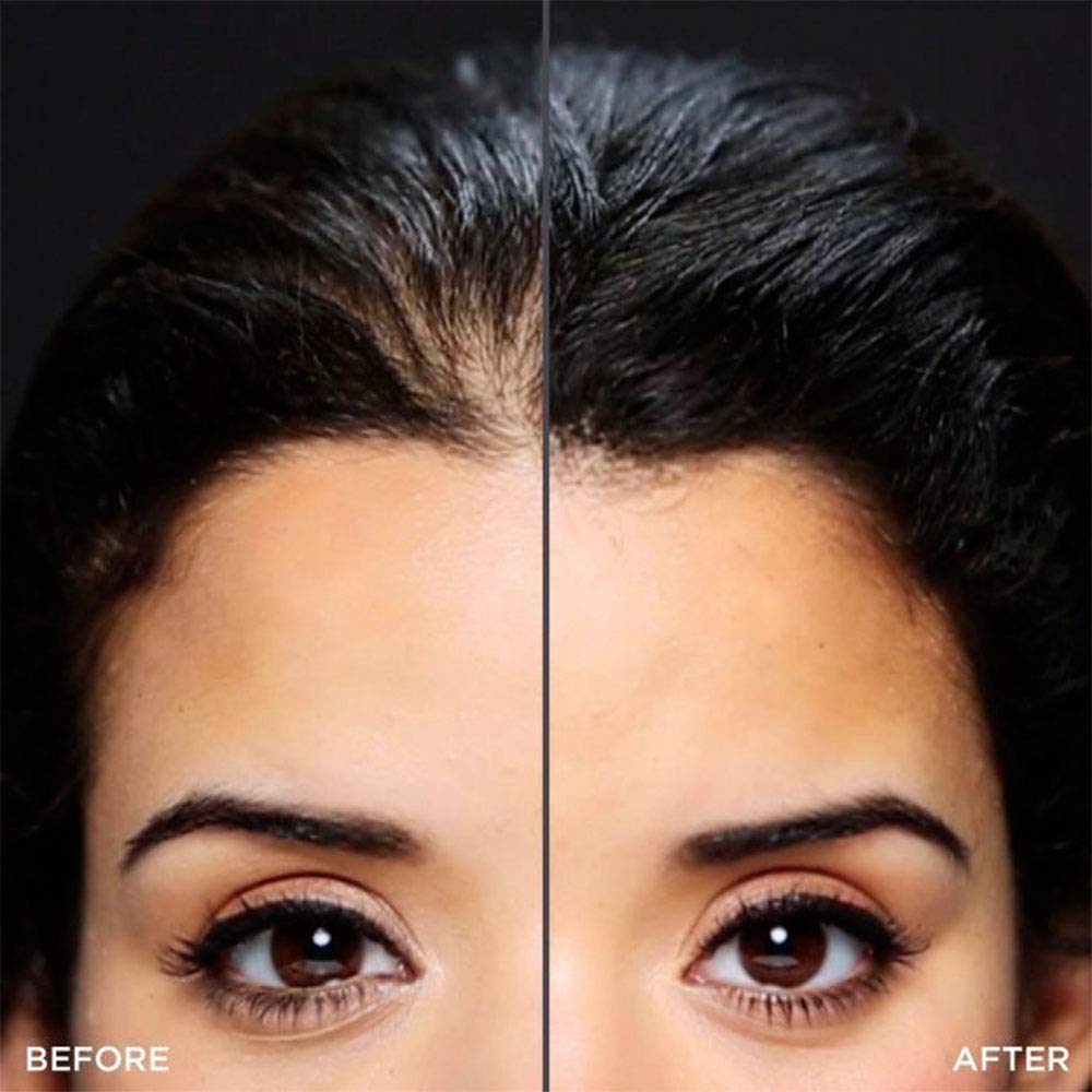 Toppik Hairline Optimizer
