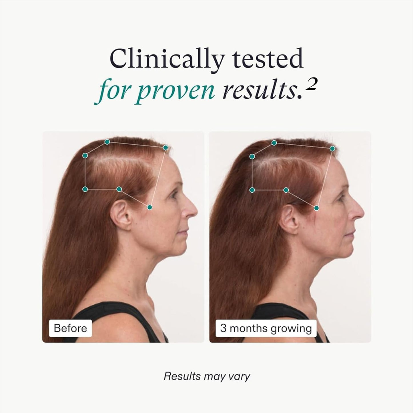 Nutrafol Women's Hair Growth Supplement